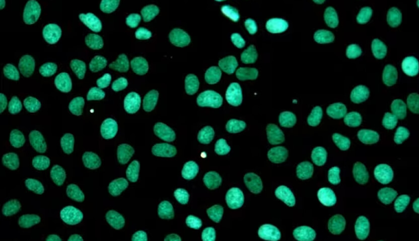 Apoptosis