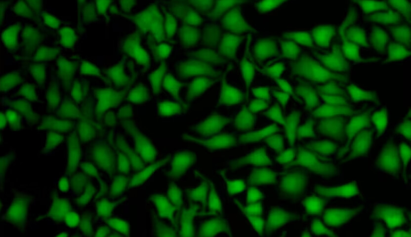 Cell Migration and Tracking