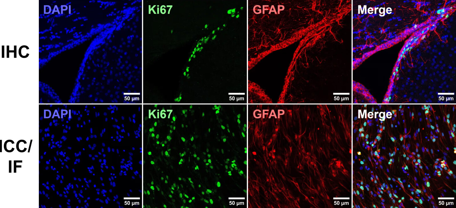 ICC vs IHC - Two rows of images depicting fluorescent IHC and ICC