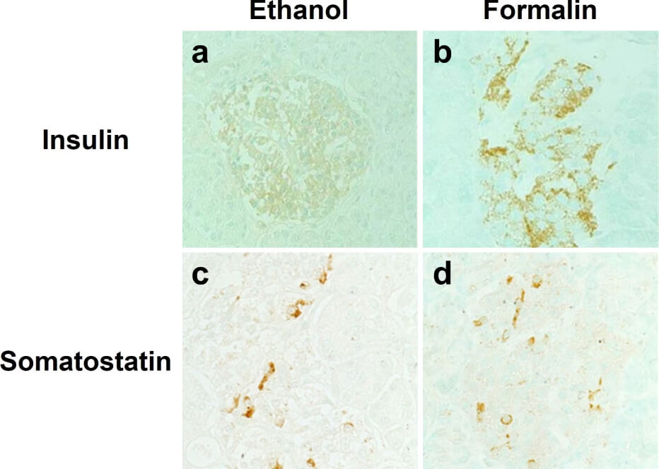 Effects of different fixatives on IHC outcome - 4 panel image depicting chromogenic IHC