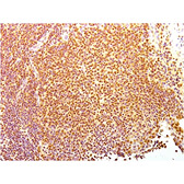 Immunohistochemistry - Anti-Human Nuclear Antigen Antibody [235-1] (A250966) - Antibodies.com